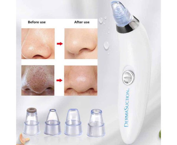 Blackhead Suction Remover & Pore Vacuum