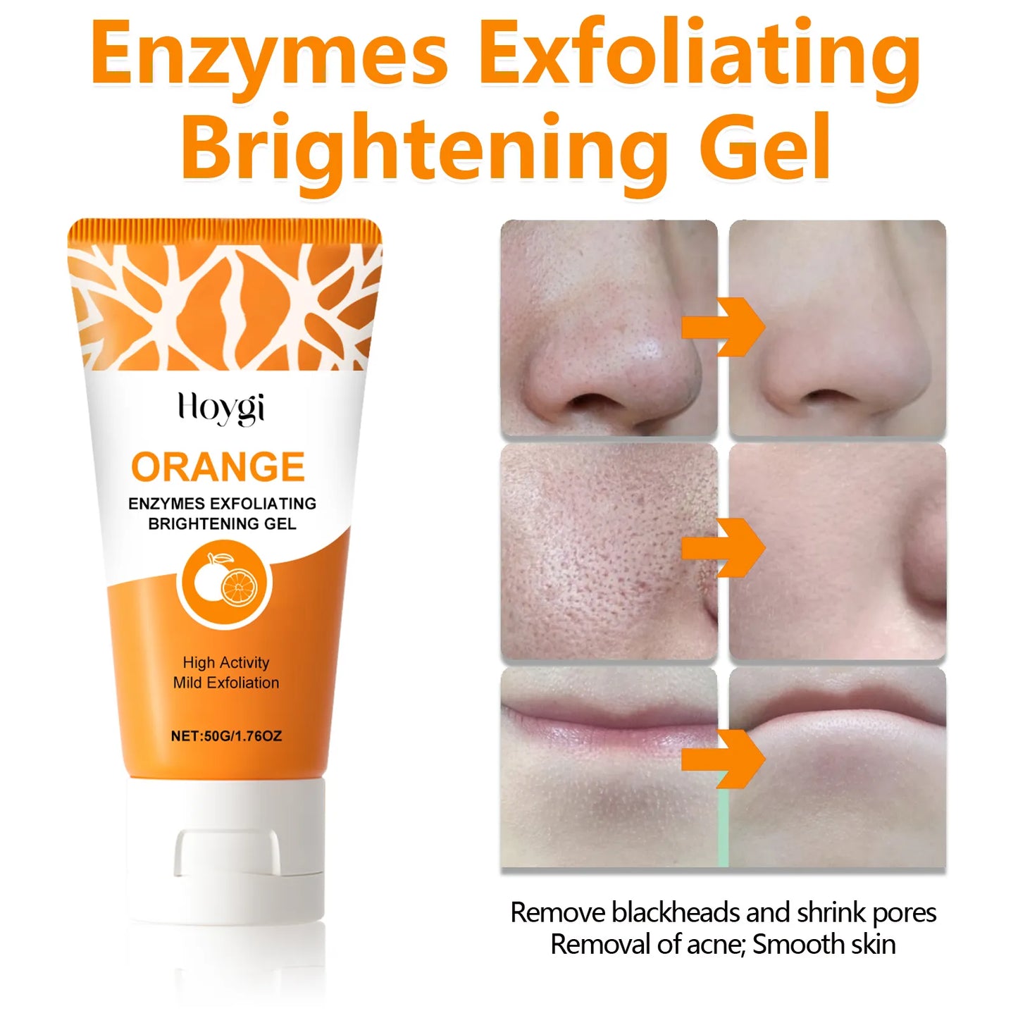 Hoygi Exfoliating Blackhead Gel Shrinks Pores and Brightens Gently Exfoliating Blackheads Are Smooth and Delicate