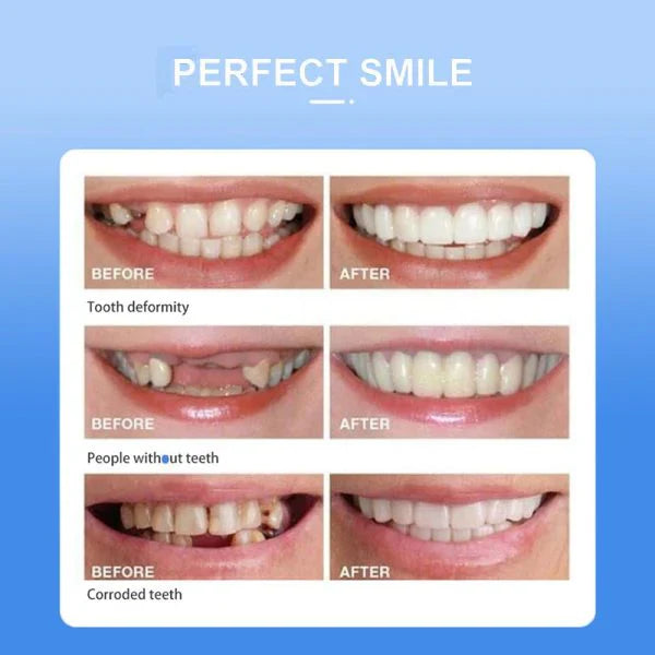Snap on Smile Instant Confidence with a Brighter